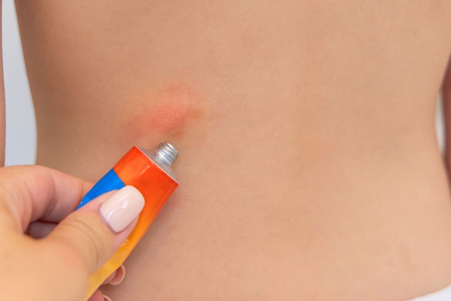 Crema con antihistamínico tópico